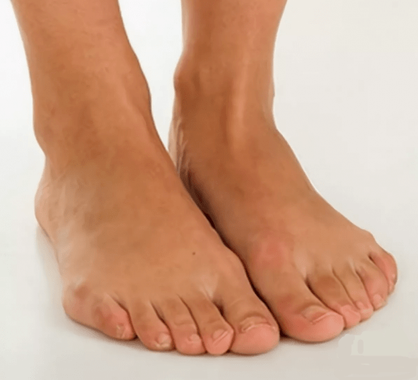 Zdrave noge nakon tretmana Hondrox sprejom