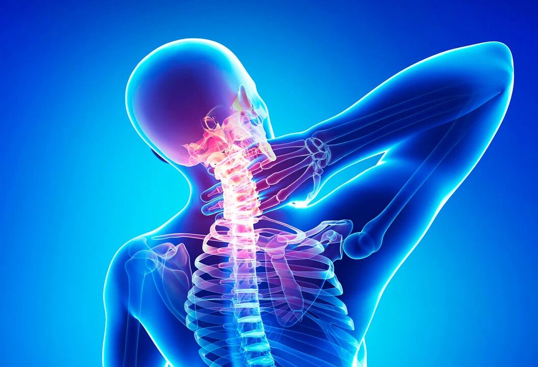 Osteokondroza kralježnice je česta bolest koja zahtijeva liječenje. 