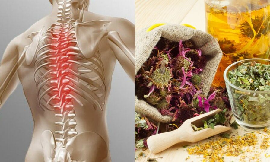 Tradicionalni recepti - sprječavaju razvoj osteohondroze i podržavaju zdravlje kralježnice