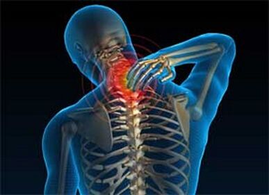 Bol u vratu čest je simptom osteohondroze
